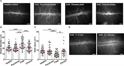 Alpha4 beta7 integrin controls Th17 cell trafficking in the spinal cord leptomeninges during experimental autoimmune encephalomyelitis